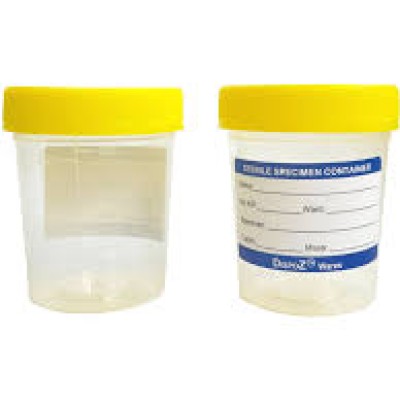 URINE SPECIMEN YELLOW CONTAINER 60ML