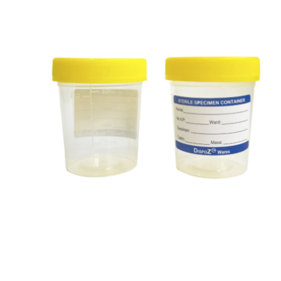 URINE SPECIMEN YELLOW CONTAINER 60ML 1S